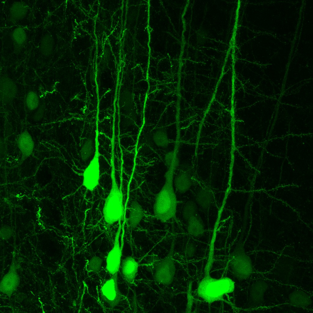 Cometas en el cerebro